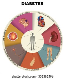 Diabetes complications detailed info graphic