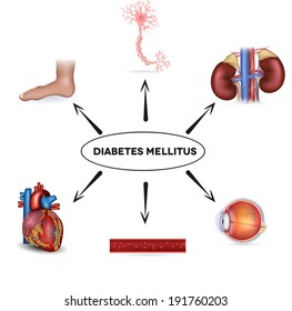 Diabetes mellitus affected areas. Diabetes affects nerves, kidneys, eyes, vessels, heart and skin.