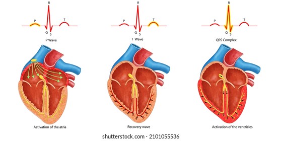 Diagram Of Heart Waves, P-waves, P-waves And QRS Complex