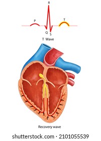 Diagram Of Heart Waves, P-waves, P-waves And QRS Complex