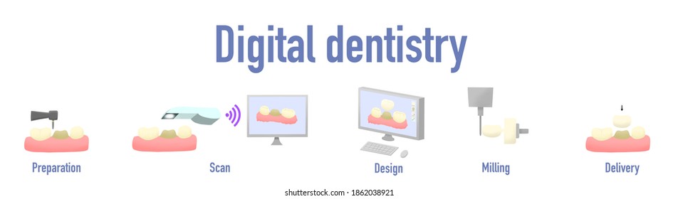 Digital Dentistry Concept. The Protocol Of Dental Ceramic Crown Processing From Tooth Preparation To Crown Delivery.