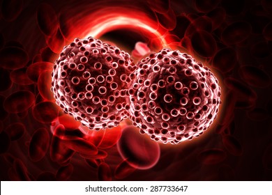 Digital Illustration Of Lung Cancer Cells In Color Background