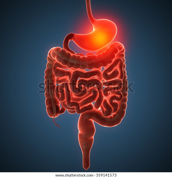 Disease Illustration Human Stomach Stock Illustration 359141573