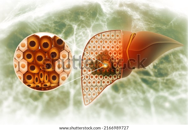 Diseased liver, damaged cells on abstract\
medical background, 3d\
illustration