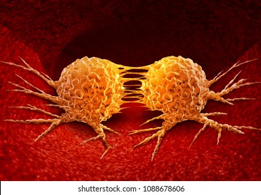 Dividing Cancer Cell Metastasis Division As A Disease Anatomy Concept As A Growing Malignant Tumor On An Organ Inside The Human Body As A 3D Illustration.