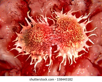 Dividing cancer cells