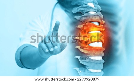 Doctor check and diagnose the human spinal cord injury, back pain on blurred background. 3d illustration Сток-фото © 