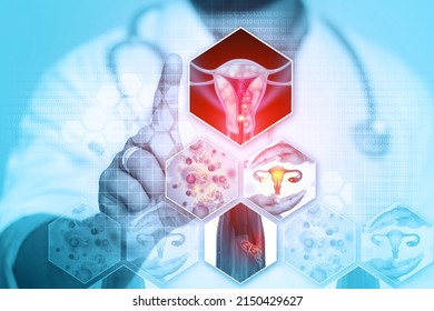 Doctor's hand shows female reproductive system diseases. Uterus cancer and endometrial malignant tumor as a uterine medical concept. 3d illustration