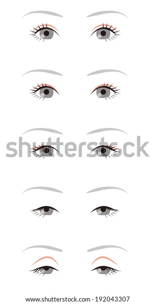 single fold eyelid