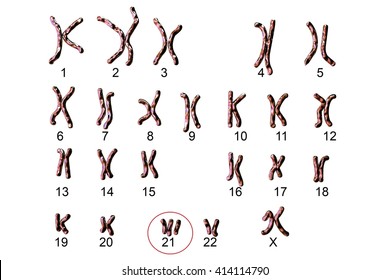 Down-syndrome karyotype, female, labeled, isolated on white background. Trisomy 21. 3D illustration