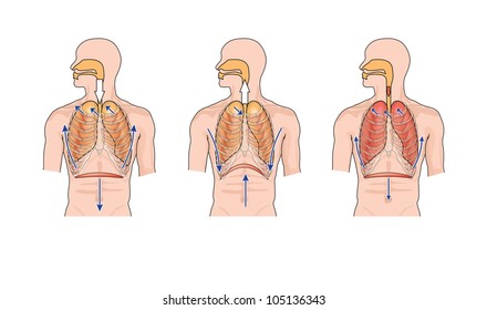 Drawing to show normal breathing (inhalation and exhalation), and the effects of lung trauma