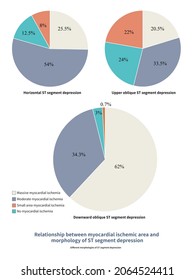 During Acute Myocardial Ischemia, Different Ischemic Areas Of Myocardium Produce Different Forms Of ST Segment Depression.