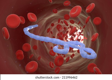 Ebola Virus