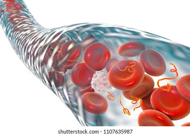 Ebola viruses in blood of a patient with Ebola hemorrhagic fever, 3D illustration. Viruses are seen as small orange thread-like structures between blood cells