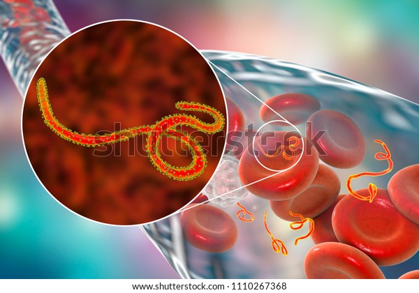 エボラ出血熱患者の血液中のエボラウイルス 3dイラスト のイラスト素材