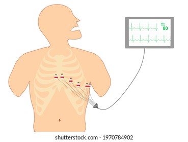 ECG 12-lead Precordial Lead Placement. Electrocardiography Monitoring.