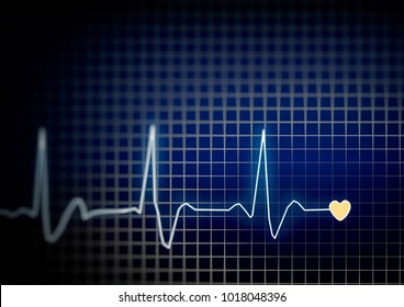 ECG Electro Cardiogram