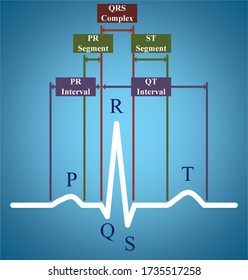 ECG Or Electrocardiogram Showing PR Interval And QT Interval