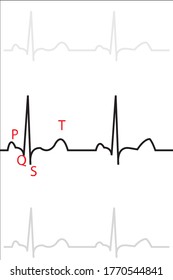 Ecg Wave Illustration Normal Heart Stock Illustration 1770544841 ...