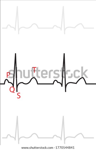 Ecg Wave Illustration Normal Heart Stock Illustration 1770544841 ...