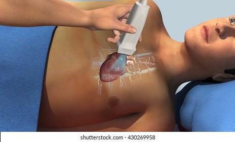 Echocardiogram 3d illustration