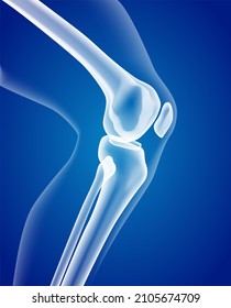 Educational medical illustration of leg bones and knee.
