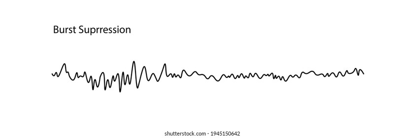 EEG(electroencephalography) Burst Supression.  High-voltage electrical activity followed periods of no activity. 