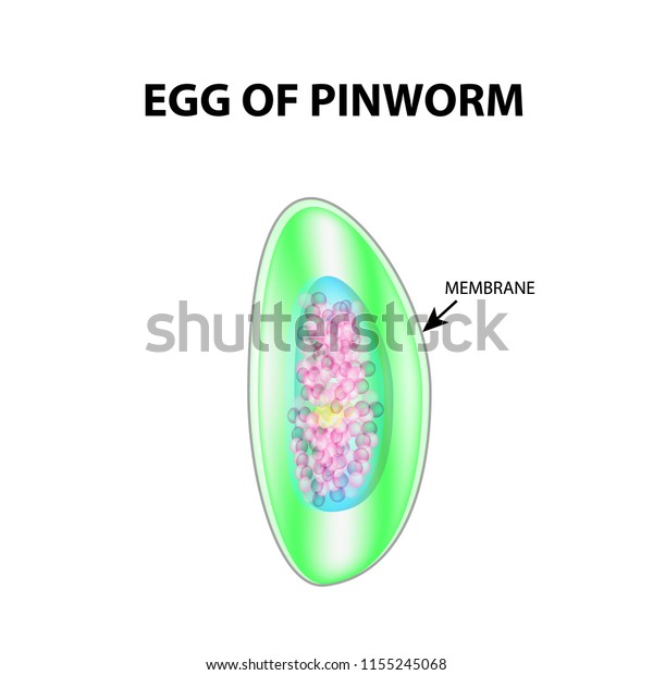 Egg Pinworm Structure Egg Pinworm Infographics Stock Illustration ...