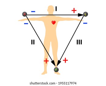 Einthoven ECG Triangle, Including Augmented Unipolar Limb Lead Illustration