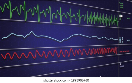 波形 心電図 のイラスト素材 画像 ベクター画像 Shutterstock