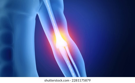 Elbow joint pain. 3d illustration - Powered by Shutterstock