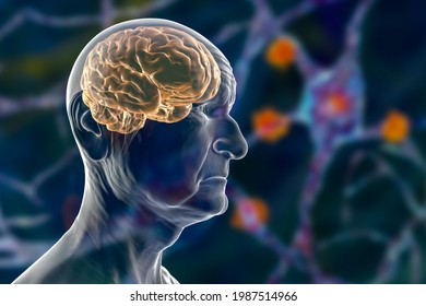 An elderly person with highlighted brain. Dementia, conceptual 3D illustration showing progressive impairment of brain functions in elderly age.