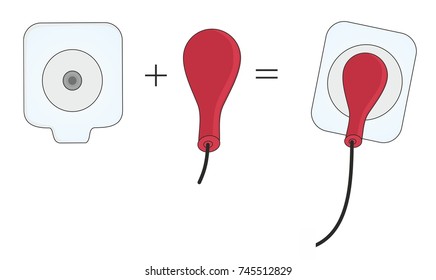 In Electrocardiography, ECG Or EKG, Electrodes Have Self-adhesive Pad To Attach The Skin.