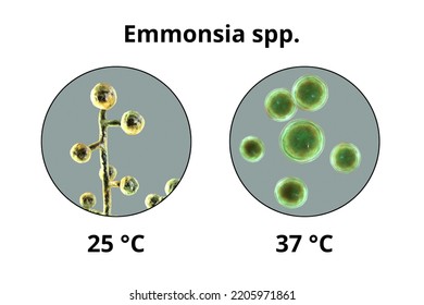 Emmonsia Microscopic Pathogenic Fungi, 3D Illustration. The Causative Agent Of Adiaspiromycosis Pulmonary Disease In Small Animals, And Also Lung And Disseminated Infections In HIV-positive Patients