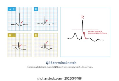 148 Qt interval Images, Stock Photos & Vectors | Shutterstock