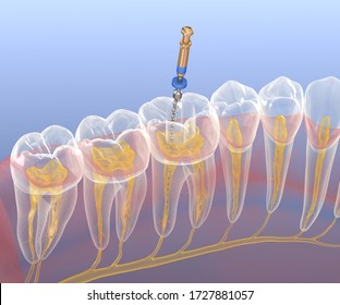 172 3d Nerve Filling Images, Stock Photos & Vectors | Shutterstock