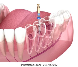 172 3d Nerve Filling Images, Stock Photos & Vectors | Shutterstock