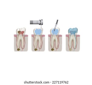 Endodontics