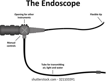 The Endoscope Labeled