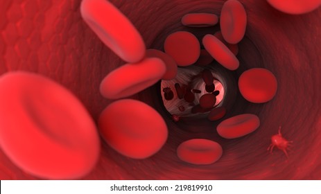 Endothelium, Erythrocyte, Medical 3d Illustration - Human Blood Cells