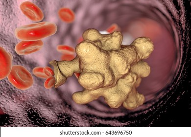 Entamoeba histolytica protozoan in blood. Parasite which causes amoebic dysentery and ulcers, 3D illustration Stock Illustration
