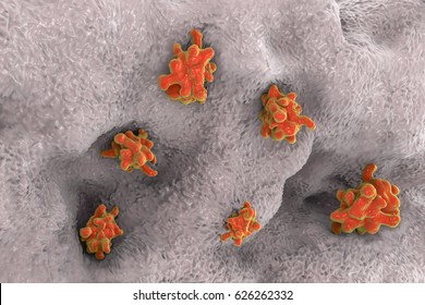 Entamoeba histolytica protozoan invading intestine. Parasite which causes amoebic dysentery and ulcers. 3D illustration Stock Illustration