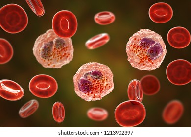 Eosinophilia, Blood Smear Showing Multiple Eosinophils Surround By Red Blood Cells, 3D Illustration. Eosinophilia Occurs In Parasitic And Fungal Infections, Allergies, Autoimmune Disorders, Tumors