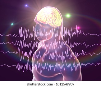 Epilepsy Awareness Concept. Brain And Encephalography In Epilepsy Patient During Seizure Attack, 3D Illustration In Purple Color