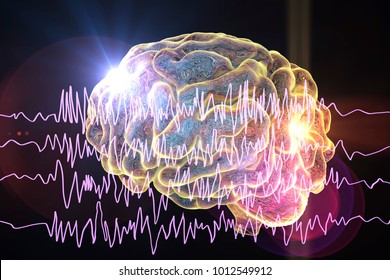 Epilepsy awareness concept. Brain and encephalography in epilepsy patient during seizure attack, 3D illustration in purple color