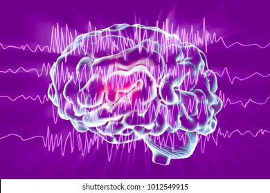 Epilepsy Awareness Concept. Brain And Encephalography In Epilepsy Patient During Seizure Attack, 3D Illustration In Purple Color