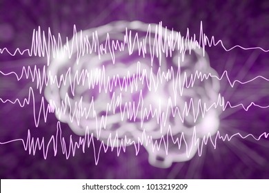 Epilepsy Awareness Concept. Brain And Encephalography In Epilepsy Patient During Seizure Attack, 3D Illustration In Purple Color