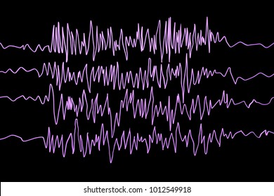 Epilepsy Awareness. Electroencephalography In Epilepsy Patient During Seizure Attack, 3D Illustration