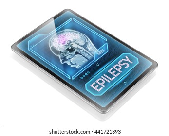 Epileptic Seizure (3D Illustration)