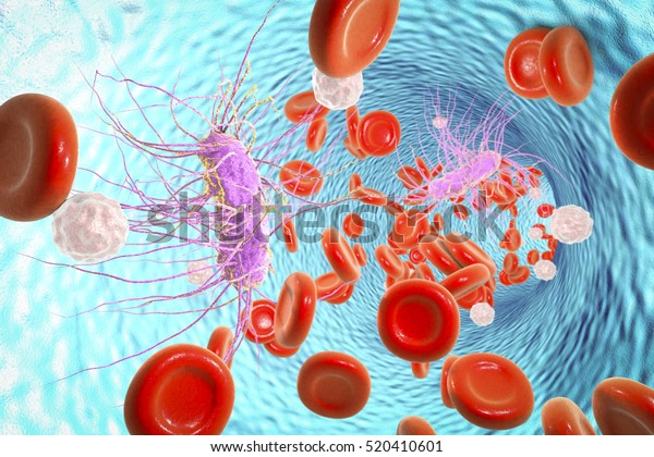 血液中の大腸菌 3dイラスト 敗血症菌血症 図は棒状の細菌eを示しています 周毛性鞭毛菌 のイラスト素材